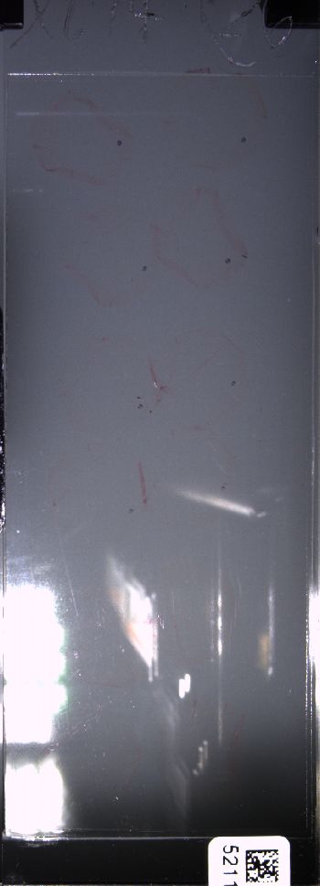 Media type: image; Special Collections 4011   shows specimen_part histological serial section;